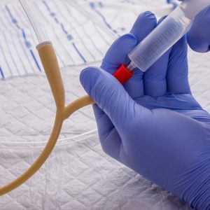 Sostituzione di catetere vescicale studio podologia Sangiorgi, podologo a Imola